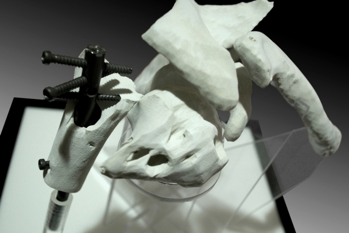Stampa 3D ossa da TAC